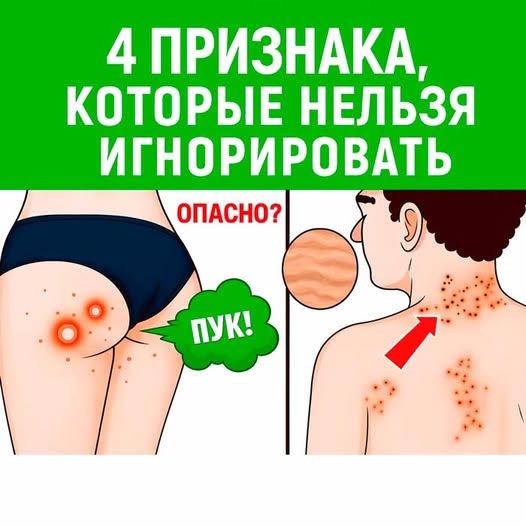 Цирроз печени: 4 тревожных симптома, которые нельзя игнорировать (№3 удивит вас)